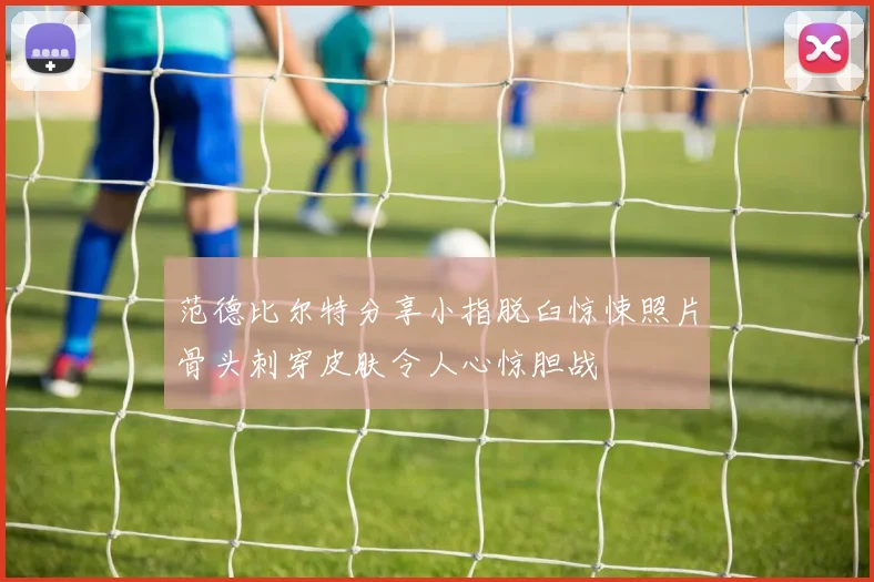 范德比尔特分享小指脱臼惊悚照片骨头刺穿皮肤令人心惊胆战